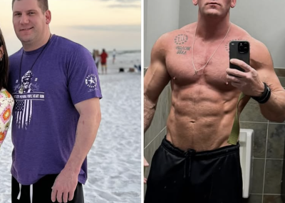 coolsculpting for men